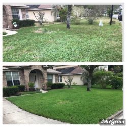 Before & After 5 treatments